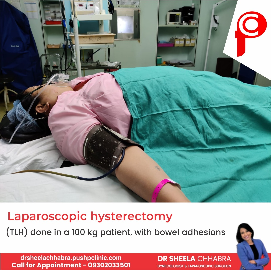 hysterectomy in indore